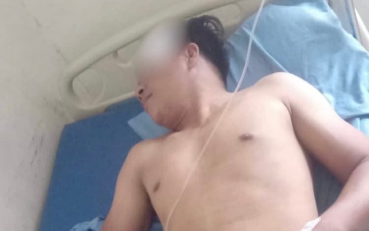 Dihajar Senjata Api, Warga Kubar Luka Parah